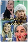 گسترش عمل های زیبایی در بازیگران زن