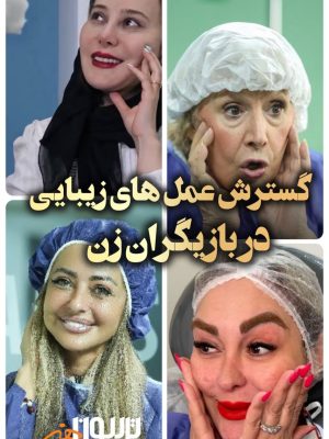 گسترش عمل های زیبایی در بازیگران زن
