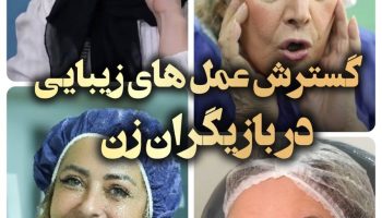 گسترش عمل های زیبایی در بازیگران زن